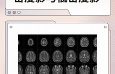 开源ct,推进医学印象技能的立异与展开